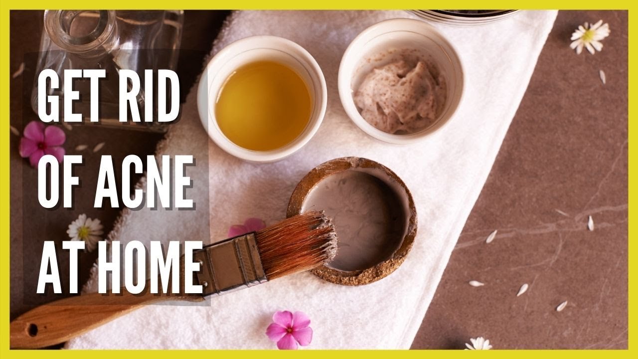 Home Remedies For Acne That Actually Work (From An Expert)
